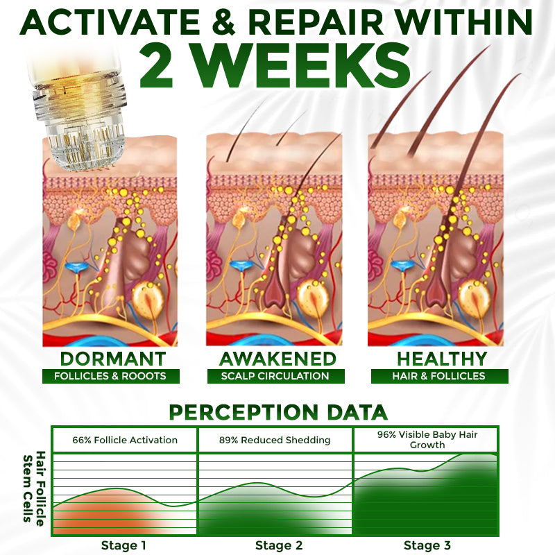 flysmus® Microneedle Herbal Infusion Hair Stimulation Set 🇺🇸