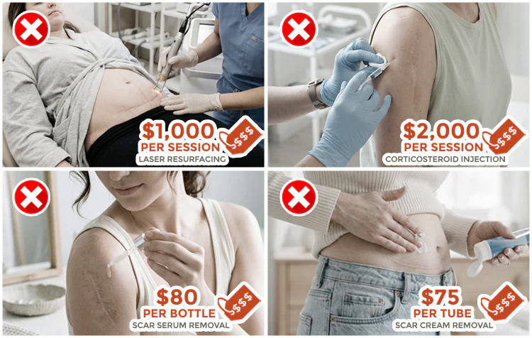 Scar treatment cost comparison before trying an at-home scar care routine