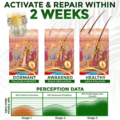 flysmus® Microneedle Herbal Infusion Hair Stimulation Set 🇺🇸