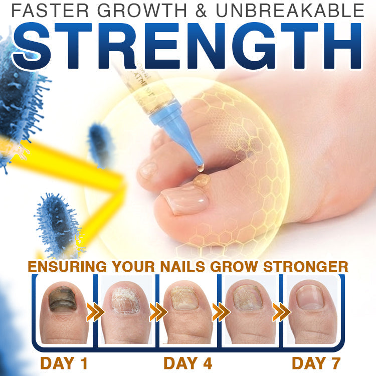 🇨🇦 CareBreeze® Fungi Free Bee Venom Nail Treatment 🥼
