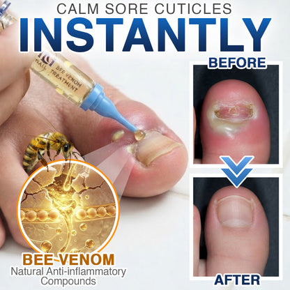 🇨🇦 CareBreeze® Fungi Free Bee Venom Nail Treatment 🥼
