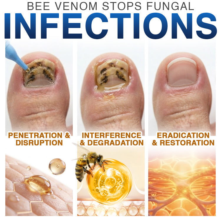 🇨🇦 CareBreeze® Fungi Free Bee Venom Nail Treatment 🥼