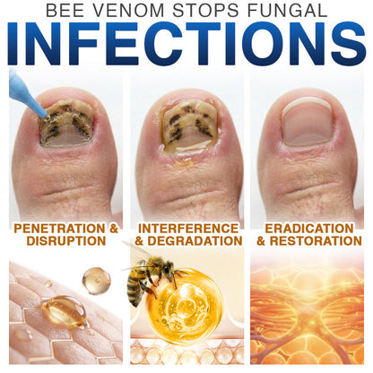🇨🇦 CareBreeze® Fungi Free Bee Venom Nail Treatment 🥼
