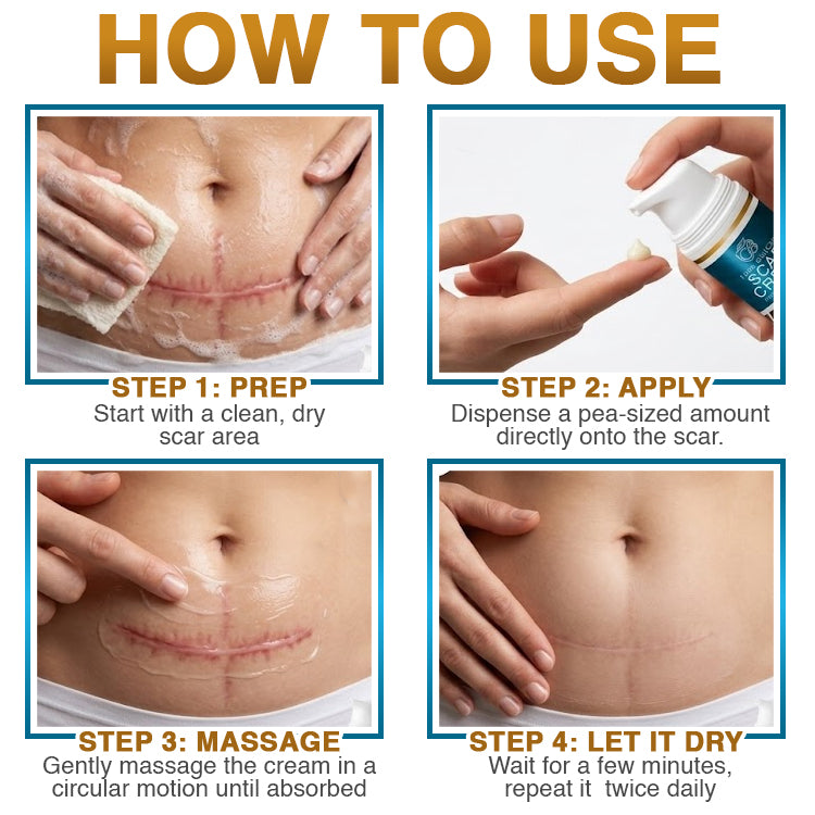 𝗖𝗮𝗿𝗲𝗕𝗿𝗲𝗲𝘇𝗲® 100% Silicone Scar Cream Formula 👨‍⚕️