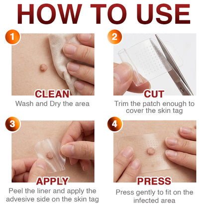 CareBreeze® Skin Tag Removal Micro-needle Patch