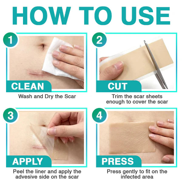 Four-Step Application