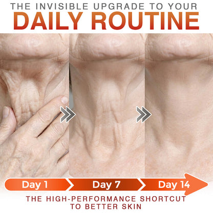 CareBreeze® Anti-Cellulite Microneedle Patch