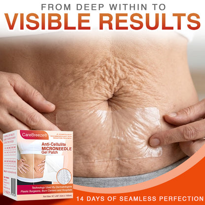 CareBreeze® Anti-Cellulite Microneedle Patch