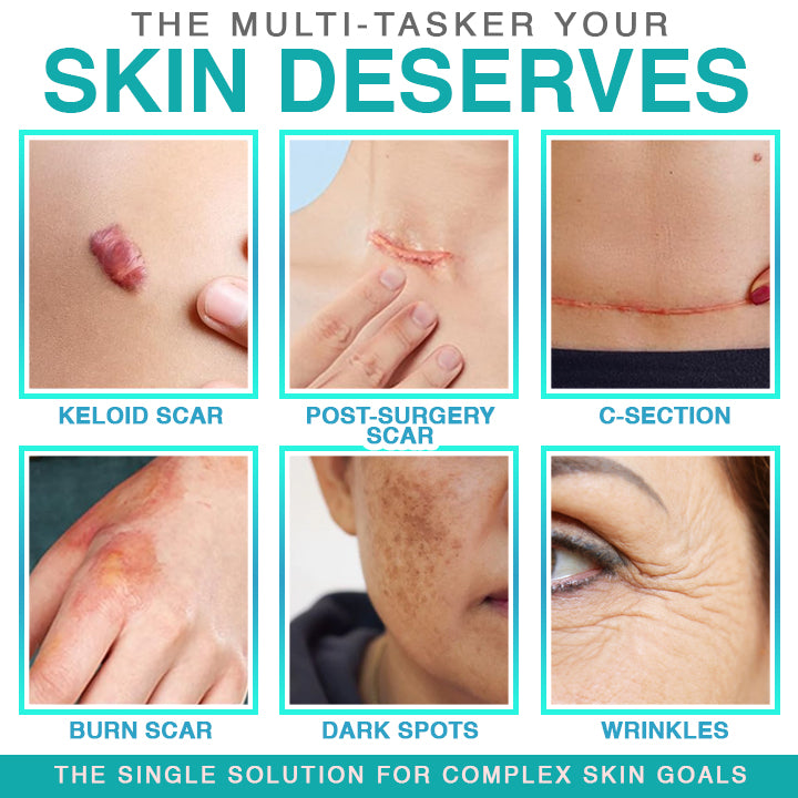 𝗖𝗮𝗿𝗲𝗕𝗿𝗲𝗲𝘇𝗲® 3-in-1 Microneedle Care Patch ✨