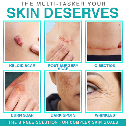 𝗖𝗮𝗿𝗲𝗕𝗿𝗲𝗲𝘇𝗲® 3-in-1 Microneedle Care Patch ✨