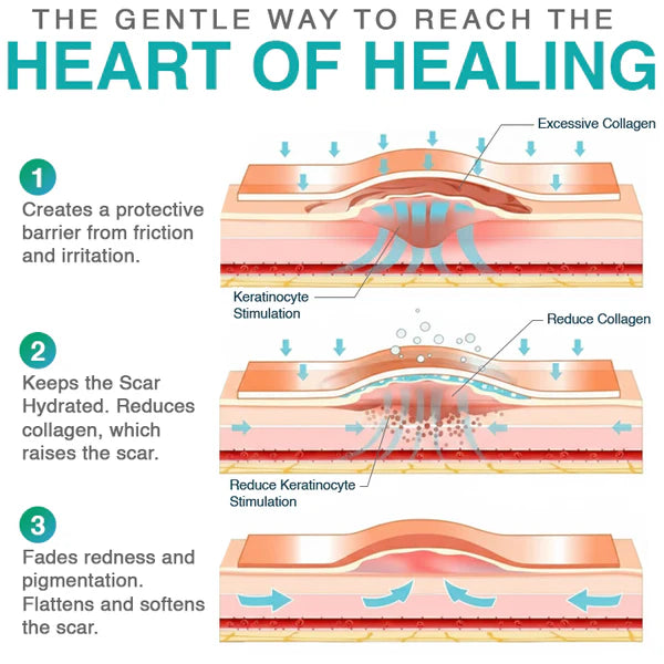 CareBreeze® Micro-Needle Scar Care Patch