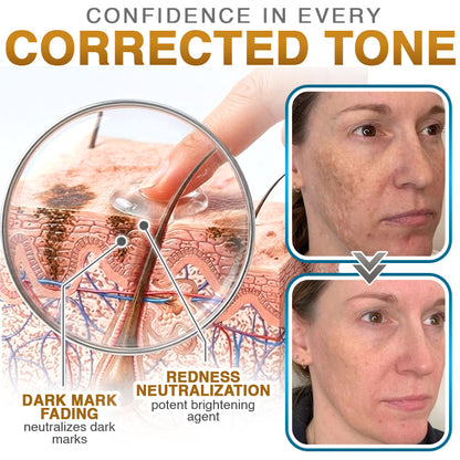 𝗖𝗮𝗿𝗲𝗕𝗿𝗲𝗲𝘇𝗲® 100% Silicone Scar Cream Formula 👨‍⚕️