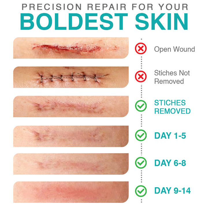 ๐๐ฎ๐ฟ๐ฒ๐๐ฟ๐ฒ๐ฒ๐๐ฒยฎ 3-in-1 Microneedle Care Patch