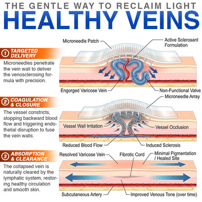 CareBreeze® Varicose Veins Treatment Microneedle Patch