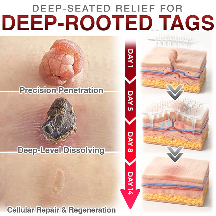 CareBreeze® Skin Tag Removal Micro-needle Patch
