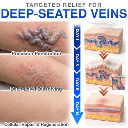 CareBreeze® Varicose Veins Treatment Microneedle Patch