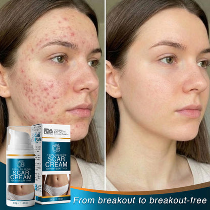 𝗖𝗮𝗿𝗲𝗕𝗿𝗲𝗲𝘇𝗲® 100% Silicone Scar Cream Formula 👨‍⚕️