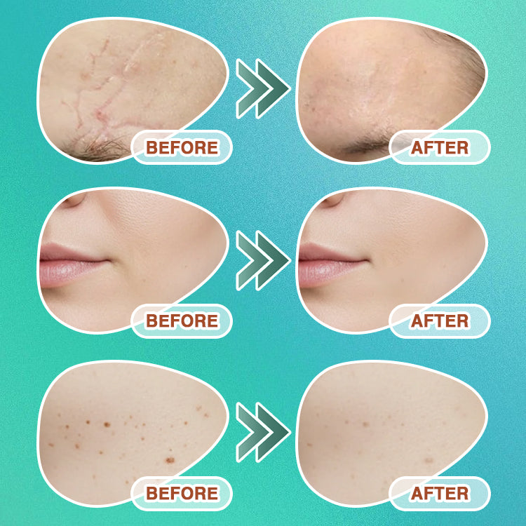 Microneedle Care Patch 🚨 VIP ACCESS ONLY | FIRST-COME, FIRST-SERVED: SECRET DISCOUNT UNLOCKED 🔓