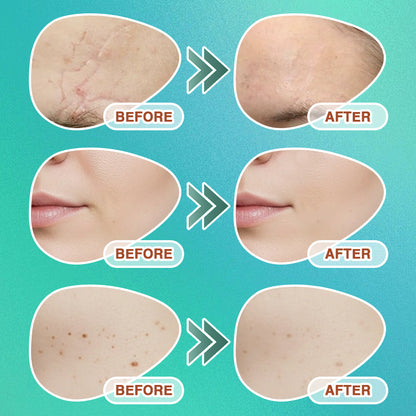 Microneedle Care Patch 🚨 VIP ACCESS ONLY | FIRST-COME, FIRST-SERVED: SECRET DISCOUNT UNLOCKED 🔓