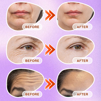 𝘾𝙖𝙧𝙚𝘽𝙧𝙚𝙚𝙯𝙚® Microneedle Anti-Aging Care Patch