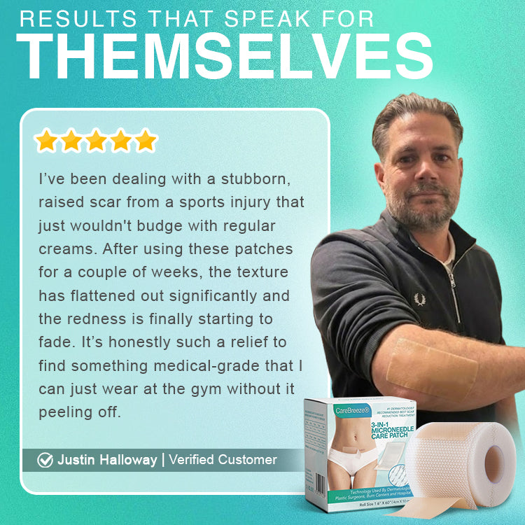 𝘾𝙖𝙧𝙚𝘽𝙧𝙚𝙚𝙯𝙚® Microneedle Scar Care Patch