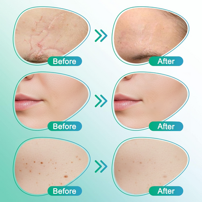 𝗖𝗮𝗿𝗲𝗕𝗿𝗲𝗲𝘇𝗲® 3-in-1 Microneedle Care Patch ✨