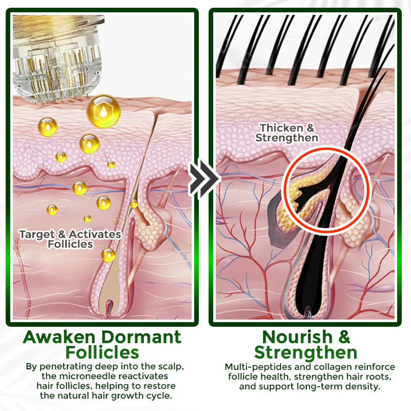 flysmus® Microneedle Herbal Infusion Hair Stimulation Set 🇺🇸
