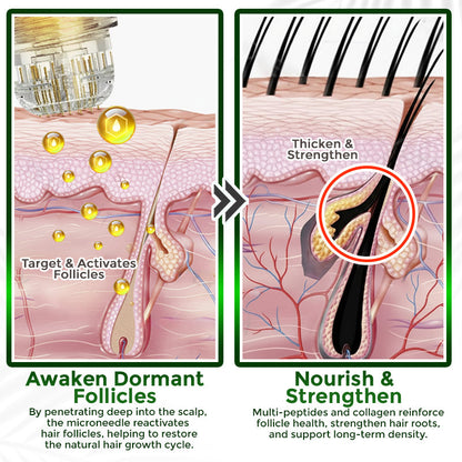 flysmus® Microneedle Herbal Infusion Hair Stimulation Set 🇺🇸