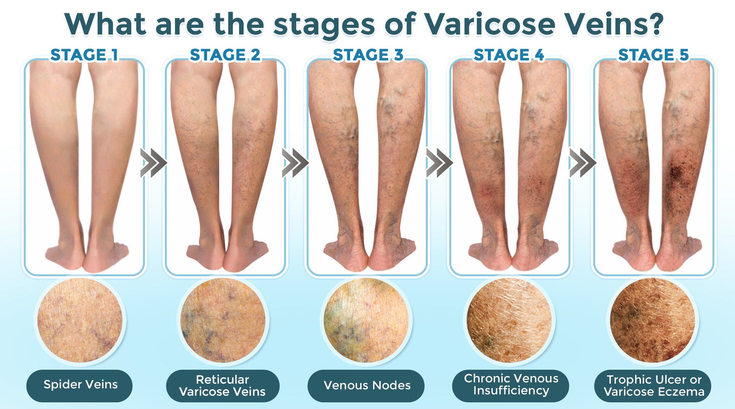 VenaRestore MicroNeedle Vein Repair Patch 🇺🇸