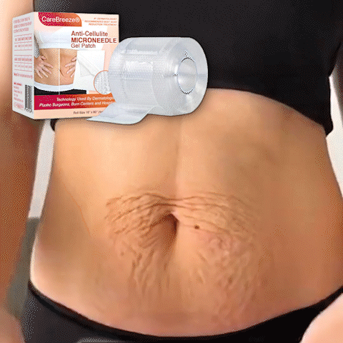 ✅ CareBreeze® Anti-Cellulite Microneedle Patch