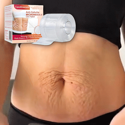✅ CareBreeze® Anti-Cellulite Microneedle Patch