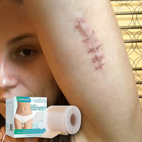 ✅ 𝗖𝗮𝗿𝗲𝗕𝗿𝗲𝗲𝘇𝗲® 3-in-1 Microneedle Care Patch
